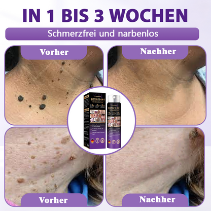 Hergestellt und versandt aus Deutschland ✨Evolvion® Biotin 10-in-1 Hautregenerations-Spray🏆-up