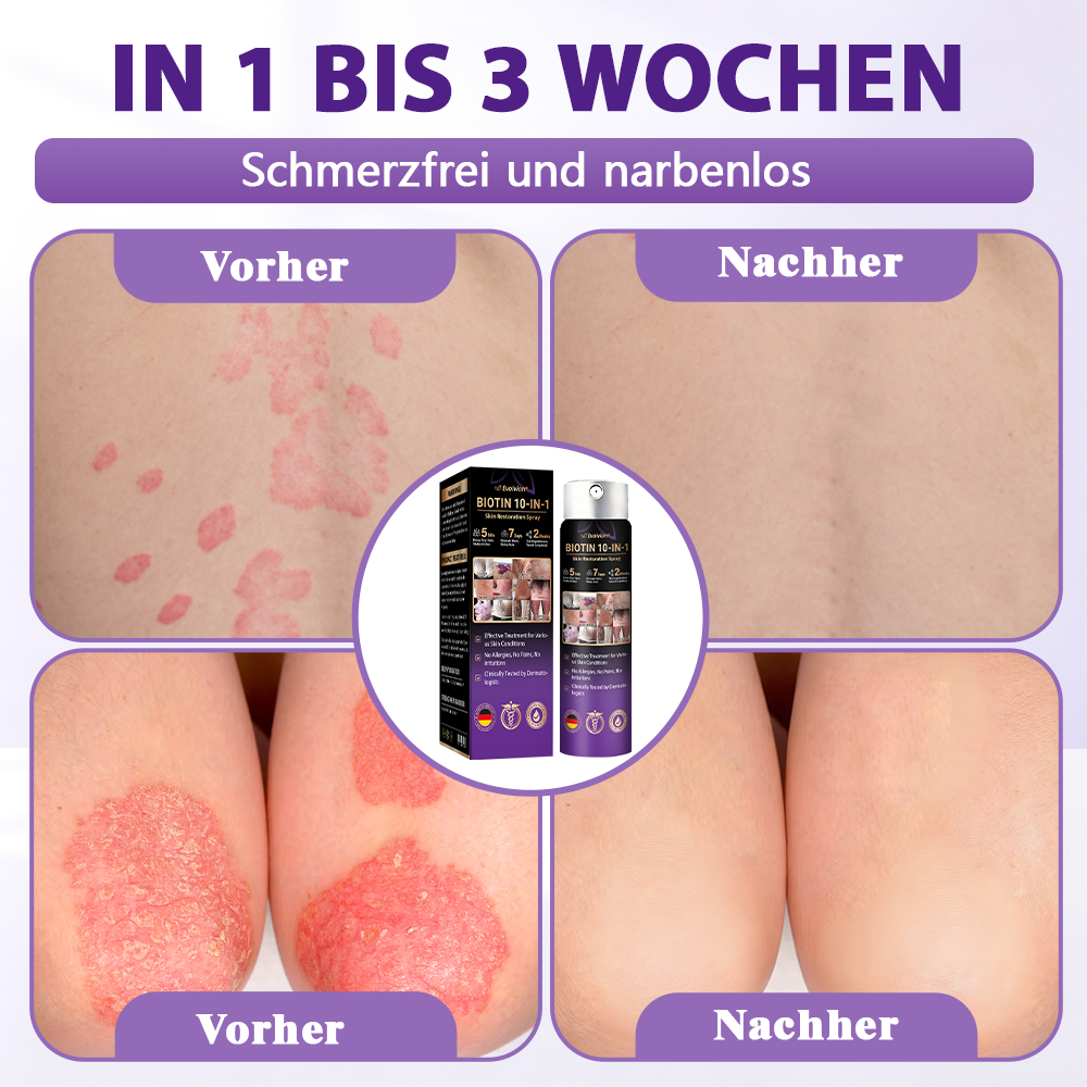Hergestellt und versandt aus Deutschland ✨Evolvion® Biotin 10-in-1 Hautregenerations-Spray🏆-up