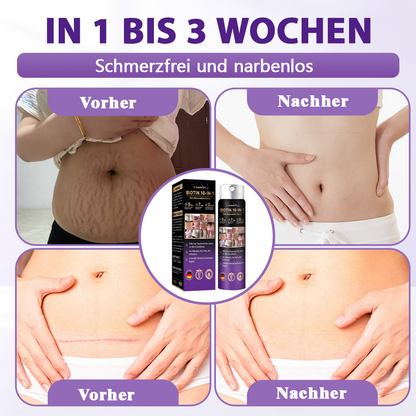 Hergestellt und versandt aus Deutschland ✨Evolvion® Biotin 10-in-1 Hautregenerations-Spray🏆-up