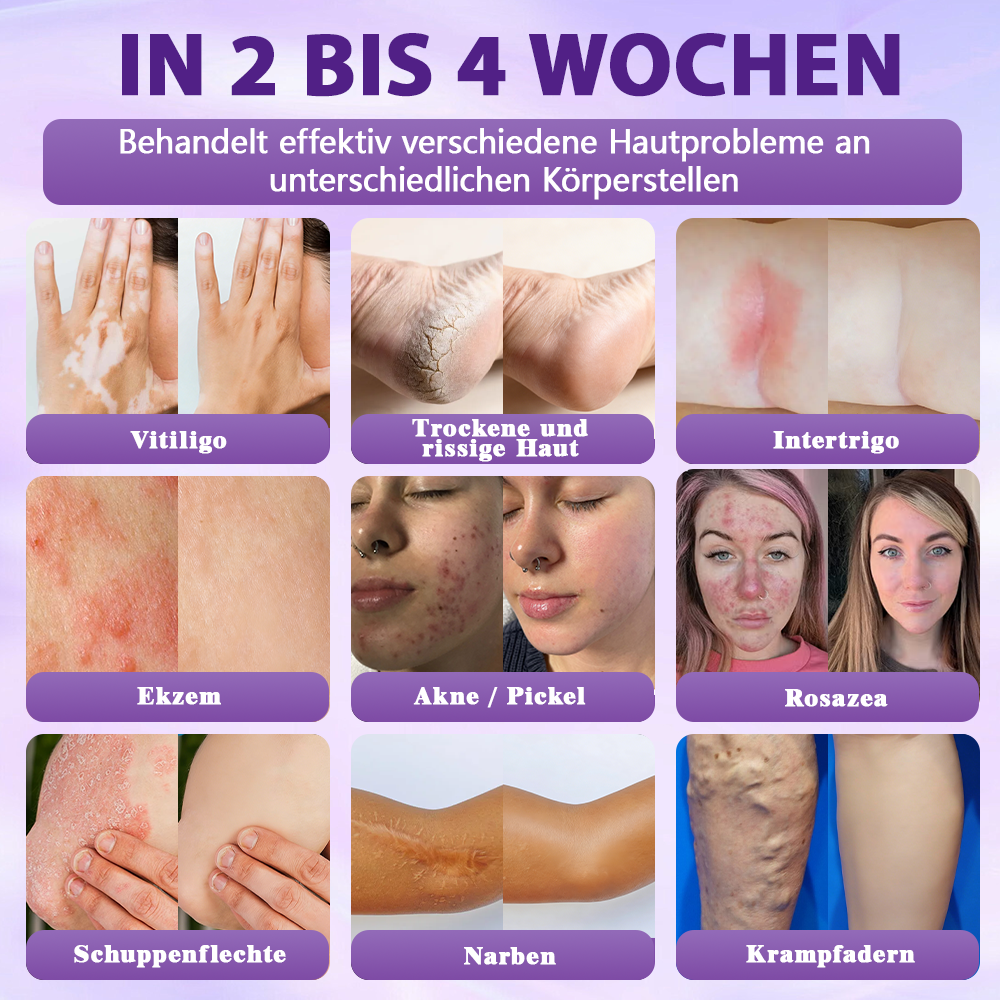 Hergestellt und versandt aus Deutschland ✨Evolvion® Biotin 10-in-1 Hautregenerations-Spray🏆-up
