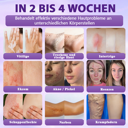 Hergestellt und versandt aus Deutschland ✨Evolvion® Biotin 10-in-1 Hautregenerations-Spray🏆-up