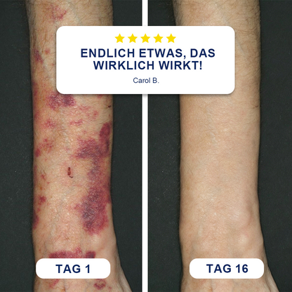 ✨Evolvion® Bluterguss-Reparatur- & hautstärkende Creme ✨
