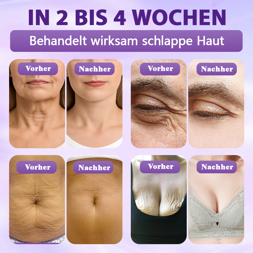 Hergestellt und versandt aus Deutschland ✨Evolvion® Biotin 10-in-1 Hautregenerations-Spray🏆-up