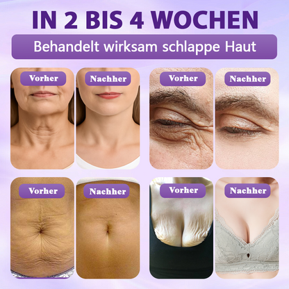 Hergestellt und versandt aus Deutschland ✨Evolvion® Biotin 10-in-1 Hautregenerations-Spray🏆-up