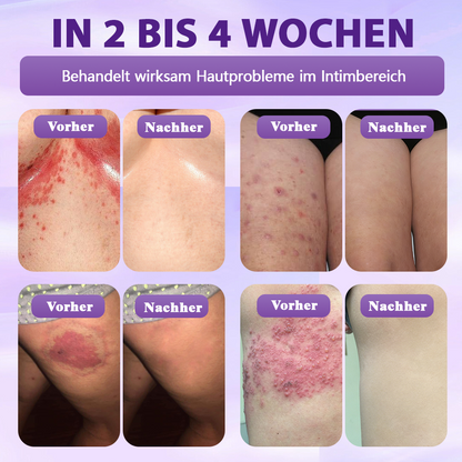 Hergestellt und versandt aus Deutschland ✨Evolvion® Biotin 10-in-1 Hautregenerations-Spray🏆-up