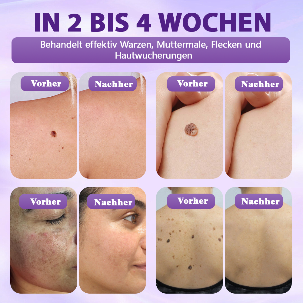 Hergestellt und versandt aus Deutschland ✨Evolvion® Biotin 10-in-1 Hautregenerations-Spray🏆-up