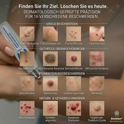 Hergestellt und versandt aus Deutschland ✨ Evolvion® 𝟕-Tage-Hautanhangs- & Pigmentflecken-Entferner – Schmerzfreie und narbenfreie fortschrittliche Lösung zur Beseitigung von Hautunreinheiten mit Roll-On-Pen ✨
