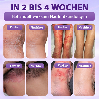 Hergestellt und versandt aus Deutschland ✨Evolvion® Biotin 10-in-1 Hautregenerations-Spray🏆-up