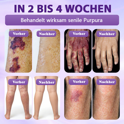 Hergestellt und versandt aus Deutschland ✨Evolvion® Biotin 10-in-1 Hautregenerations-Spray🏆-up