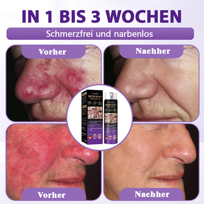Hergestellt und versandt aus Deutschland ✨Evolvion® Biotin 10-in-1 Hautregenerations-Spray🏆-up