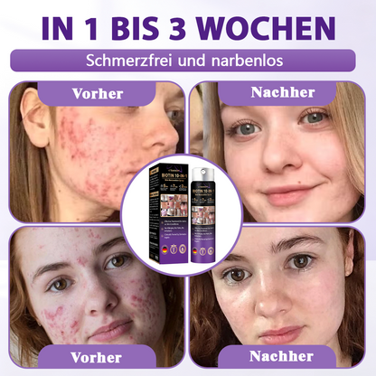 Hergestellt und versandt aus Deutschland ✨Evolvion® Biotin 10-in-1 Hautregenerations-Spray🏆-up